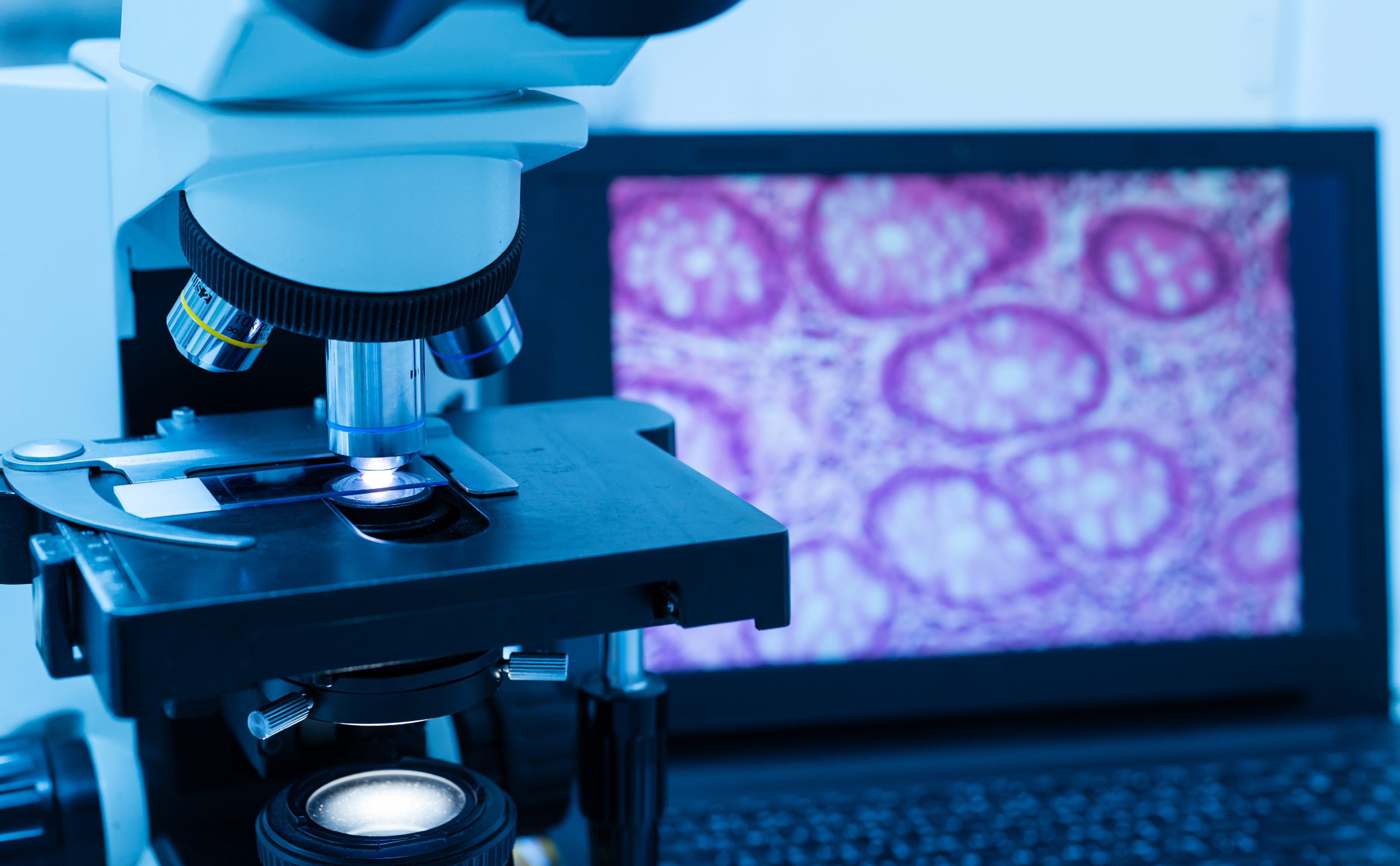 Invisible but Critical: Managing Process Residuals in Cell Therapies
